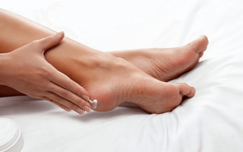 trị nứt gót chân hiệu quả bằng kem đặc trị
